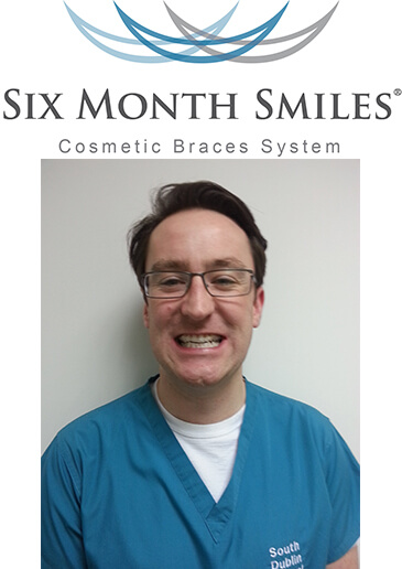 six_month_smiles_logo_for_web